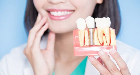 Close up of dentist holding a model of a dental implant